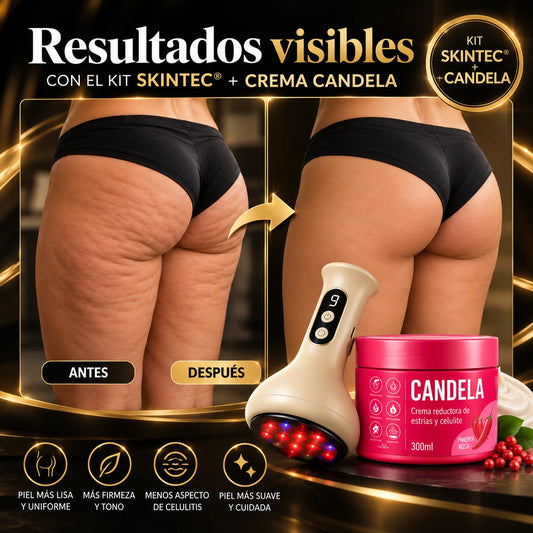 MASAJEADOR ANTICELULÍTICO SKINTEC® + Crema CANDELA 🔥