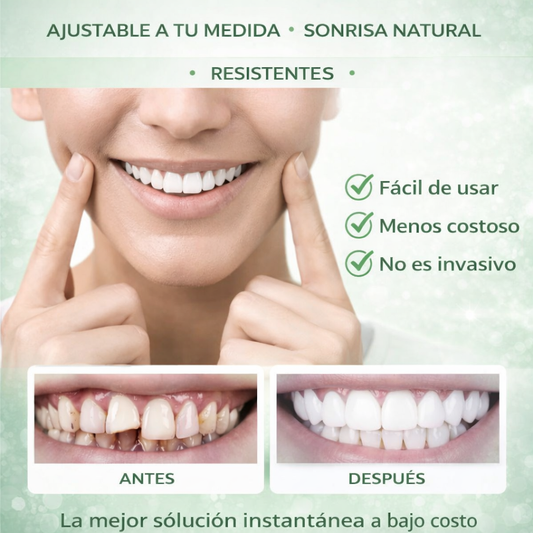 Denwhite®: Carillas Dentales