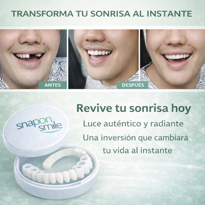 Denwhite®: Carillas Dentales